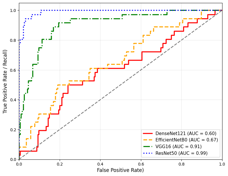 ROC Curves and AUC Performances of Baseline Architectures Trained Under Class Imbalance.