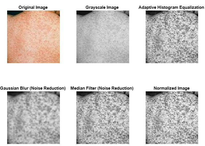 Pre-processing Stages on a Sample Image